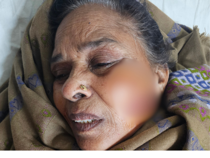 अबोहर में बेटे-बहू ने मां को पीटा:  चाबी मांगने पर वारदात की, पड़ोसियों ने बचाया - Abohar News