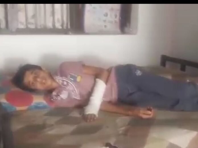 आम तोड़ने पर छात्र से मारपीट का आरोप:  छीपानेर में बच्चे के हाथ-पैर फ्रैक्चर; प्रबंधक को किया निलंबित - Harda News