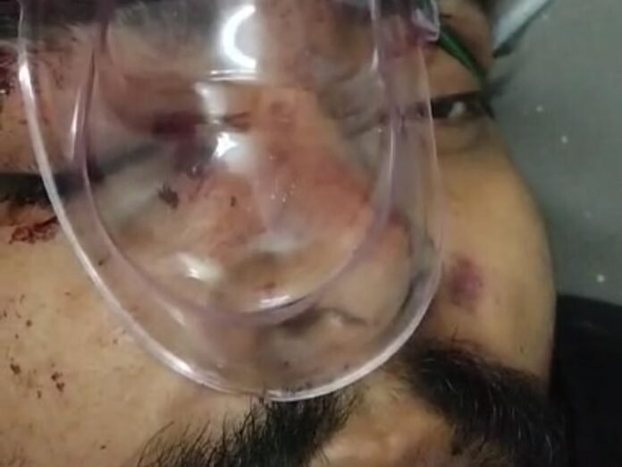 दिल्ली से लौट रहे युवक का हादसा:  माधौपुर पुल के पास ट्रेन से गिरा, एक पैर कटा; अस्पताल में भर्ती - Bareilly News
