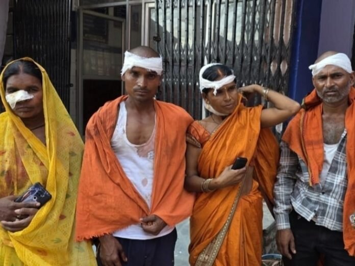 दो पक्षों की मारपीट में दंपती समेत 4 घायल:  मोबाइल चोरी के विवाद में भिड़ गए सभी, हमले में दो लोग गंभीर रूप से जख्मी - Aurangabad (Bihar) News