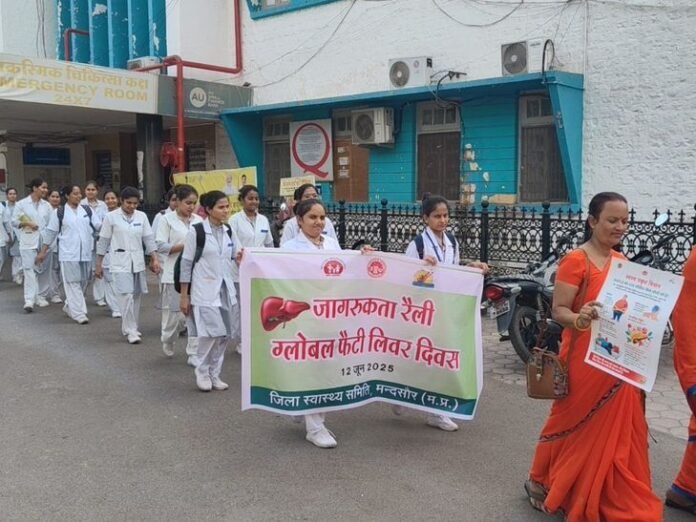 ग्लोबल फैटी लिवर दिवस पर ‘स्वस्थ यकृत मिशन’ की शुरुआत:  डॉक्टर बोले- महिलाओं की कमर की माप 80 सेंटीमीटर से अधिक तो जांच जरूरी - Mandsaur News