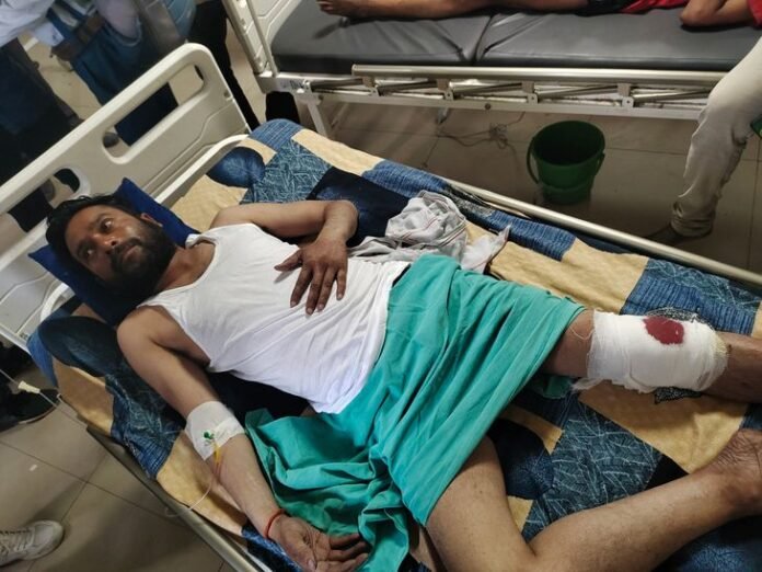 ग्वालियर में दिनदहाड़े दुकानदार को मारी गोली:  चार शहर के नाके पर फायरिंग; चेहरा छिपाकर आया था बदमाश - Gwalior News