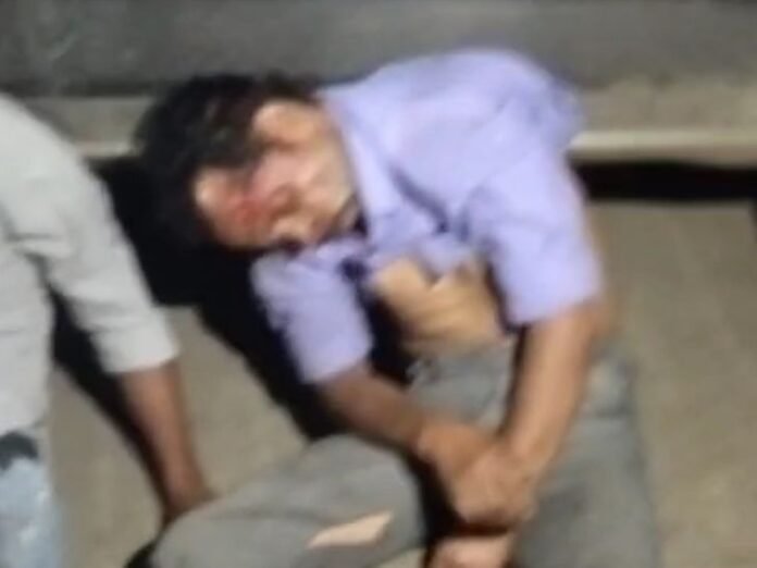 पीथमपुर में खड़ी कार का दरवाजा खोलने से बाइक टकराई:  दो घायल इंदौर रेफर, ड्राइवर मौके से भागा - Pithampur News