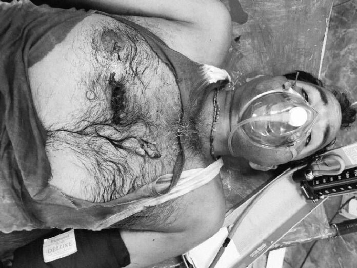 सिपाही के बाप ने गुटखा थूकने पर गोली मारी:  झांसी में युवक के सीने में आर-पार हुई, हालत नाजुक, बचाने आए भतीजे का सिर फोड़ा - Jhansi News