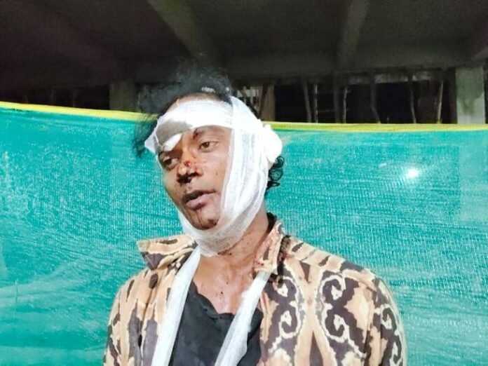 सुलतानपुर में घरेलू विवाद में मारपीट:  विकलांग मां को घर में घुसने से बेटे ने किया मना, विरोध पर भाई ने भाई को पीटा - Sultanpur News