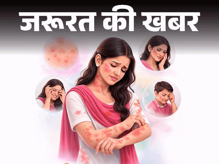 Holi Skincare Home Remedies; Synthetic Colour Chemicals Health Risks