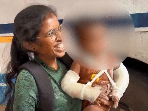 डेढ़ साल के बच्चे की शारीरिक प्रताड़ना-मारपीट से मौत:लाइटर-सिगरेट से शरीर जलाया, 51 चोटों के निशान; मां और उसका लिव-इन पार्टनर गिरफ्तार